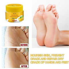 2 pcs Natural Banana Foot Cream Repair Anti Drying Crack Strengthening Cream