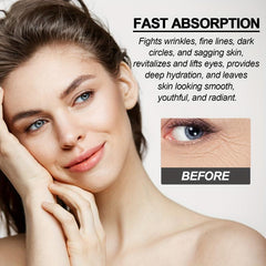 Niacinamide Eye Cream for Dark Circles Fine Lines Hydration Repair