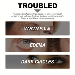 Niacinamide Eye Cream for Dark Circles Fine Lines Hydration Repair