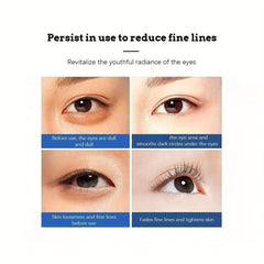 Retinol Wrinkle Eye Cream Dark Circles Moisturizing Smooth Firming