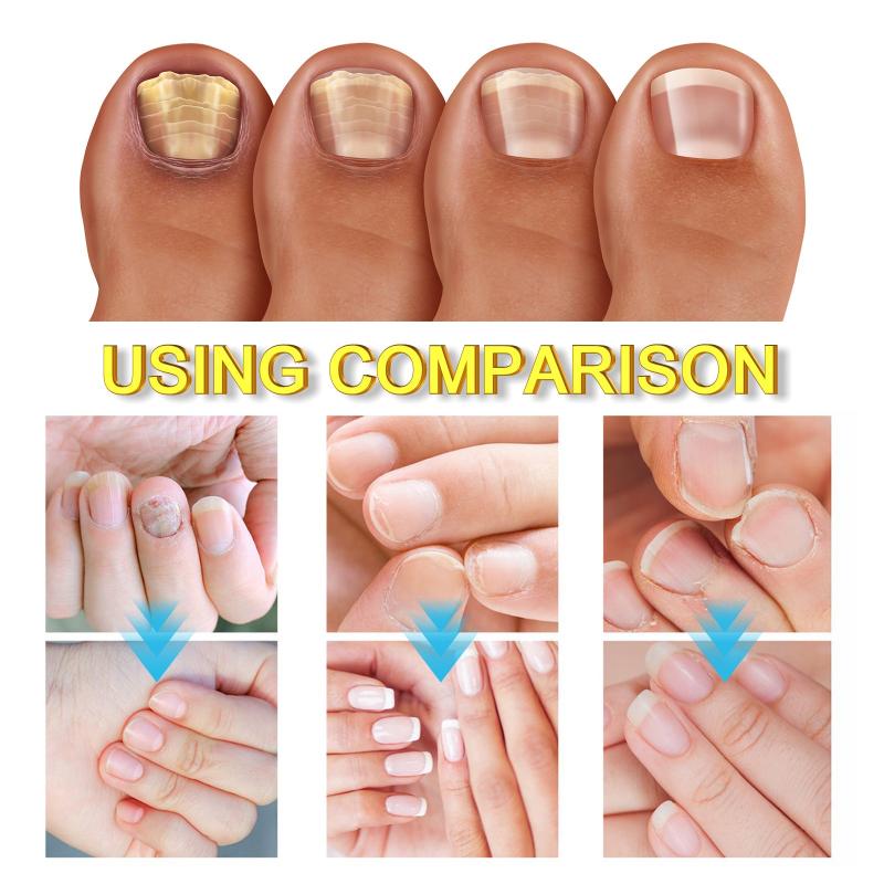 Nail Strength Balm Extra Strong Toe Cream