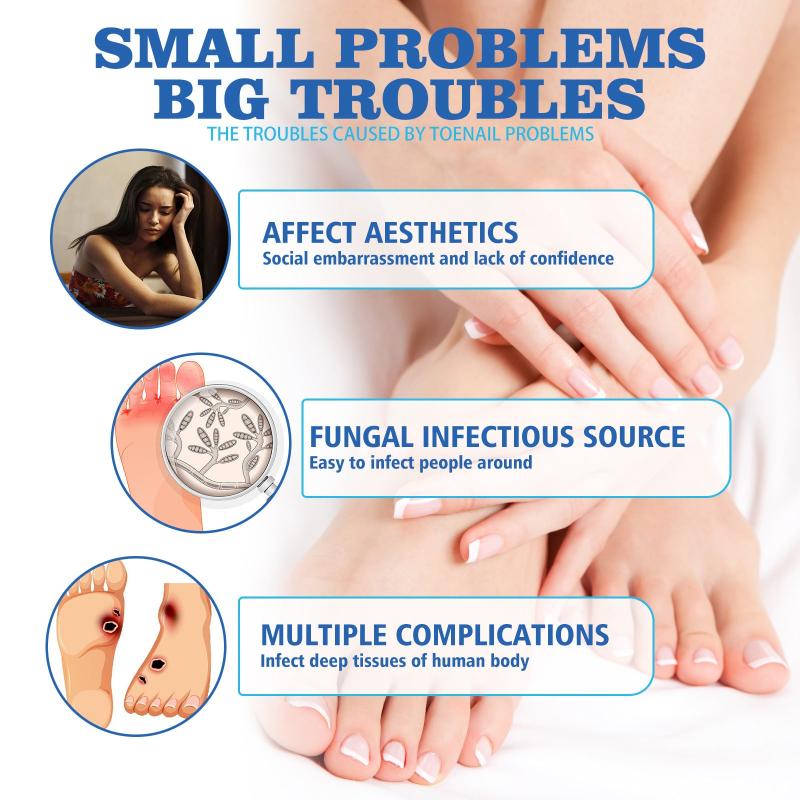 Nail Strength Balm Extra Strong Toe Cream