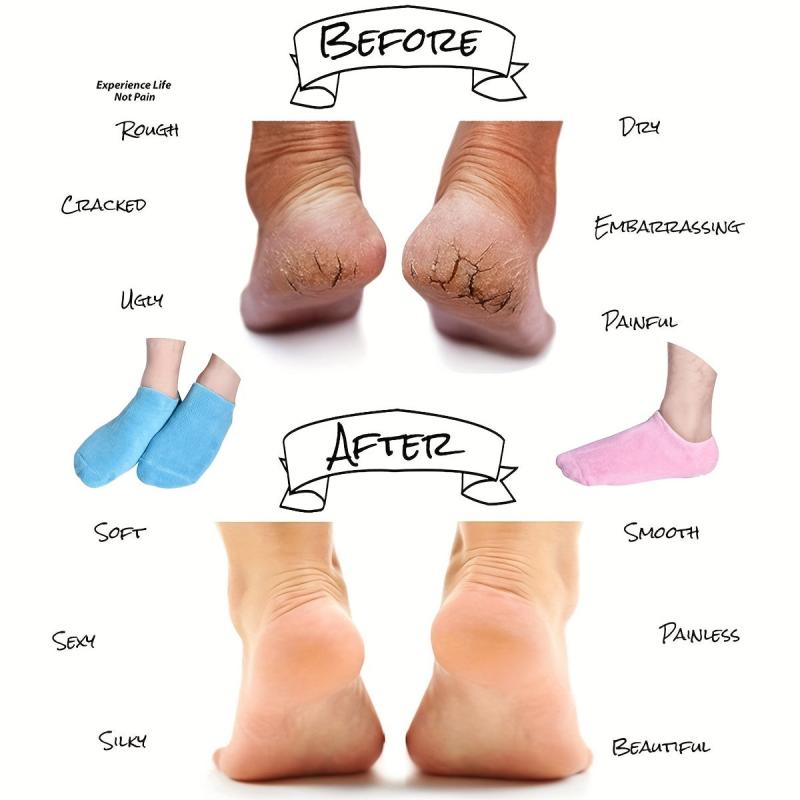 Moisturizing Silicone Socks for Dry Feet Repair - Pink