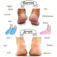 Moisturizing Silicone Socks for Dry Feet Repair - Pink
