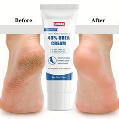 Urea Hand Cream with Salicylic Acid Callus Remover