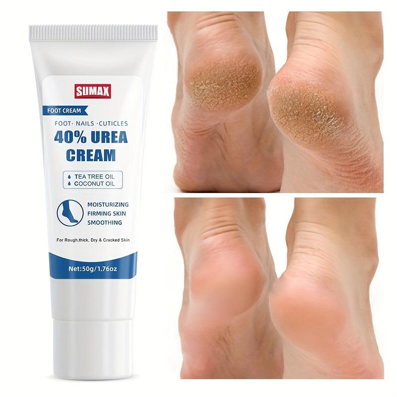 Urea Hand Cream with Salicylic Acid Callus Remover