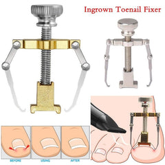 Ingrown Toenail Tool Brace Kit Toe Nail Care Clipper Fixer Adjuster