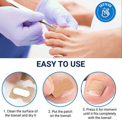 100 Pcs Ingrown Toenail Corrector Strips for Men and Women