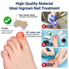 100 Pcs Ingrown Toenail Corrector Strips for Men and Women