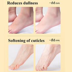 180g Foot Exfoliating Cream Dead Skin Remover