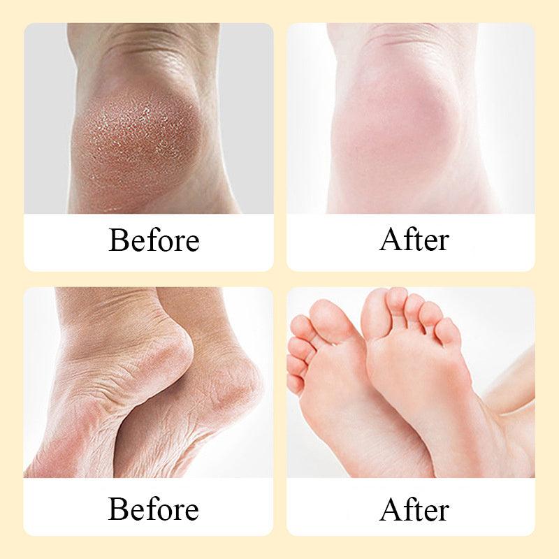 180g Foot Exfoliating Cream Dead Skin Remover
