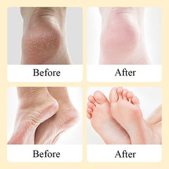 180g Foot Exfoliating Cream Dead Skin Remover