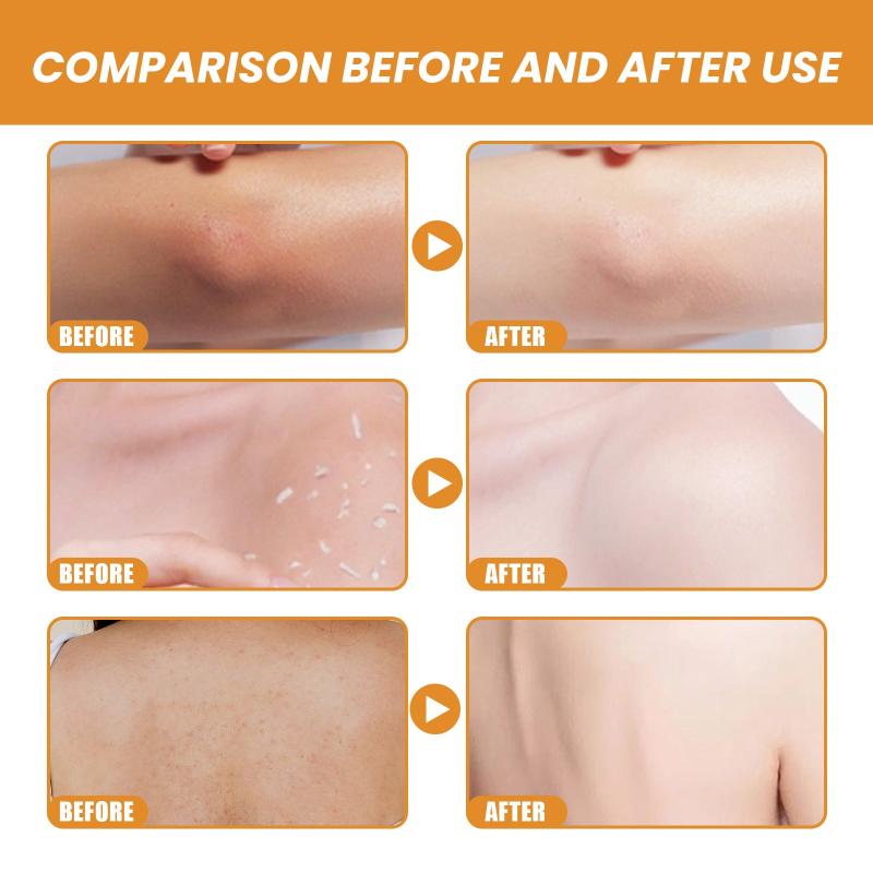2pcs Body Exfoliating Gel for Illuminating Skin