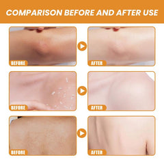 2pcs Body Exfoliating Gel for Illuminating Skin