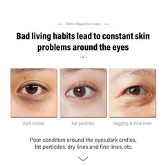 Collagen Eye Cream: Reduces Dark Circles & Wrinkles, Moisturizing