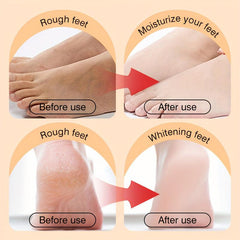 Moisturizing Foot Cream for Dry Cracked Heels