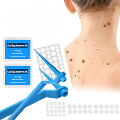 40Pcs 1.8mm Wart & Acne Removal Kit: Rubber Ring Removal & Cleansing Swabs