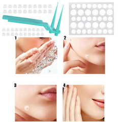 40Pcs 1.8mm Wart & Acne Removal Kit: Rubber Ring Removal & Cleansing Swabs