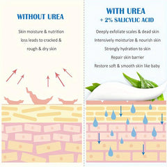 Urea Cream 48 Plus Salicylic Acid 2 Foot Cream
