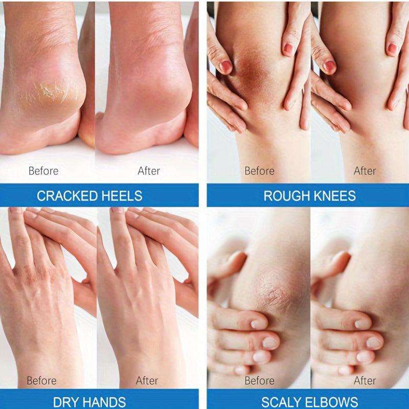 Urea Cream 48 Plus Salicylic Acid 2 Foot Cream