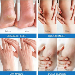 Urea Cream 48 Plus Salicylic Acid 2 Foot Cream
