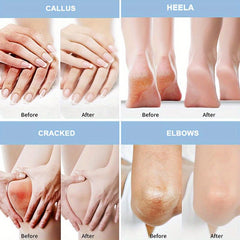 Urea Salicylic Acid Foot Cream Pump - Soften & Repair Thick Cracked Skin