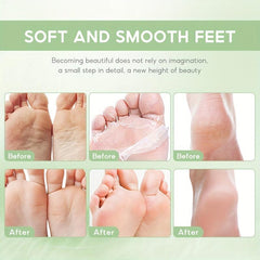 Tea Tree Foot Cream Hydrate Moisturize Soothe Athletes Foot Natural Relief