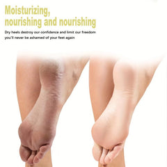 Tea Tree Foot Cream for Dry Feet