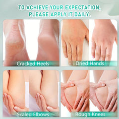 Tea Tree Foot Cream for Dry Feet