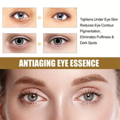 Eye Essence Reduces Wrinkles Dark Circles Aging Resistance Serum