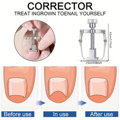 Ingrown Toenail Tool Kit Stainless Steel Clippers for Thick and Ingrown Nails