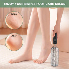 Professional Stainless Steel Foot Rasp Callus Remover