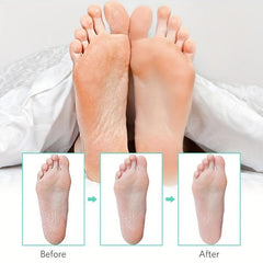Professional Foot File Pedicure Planer to Remove Dead Skin
