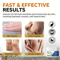Thyme Foot Cream for Dry Cracked Feet