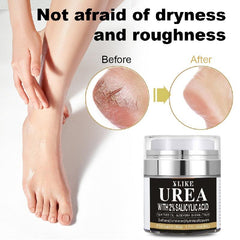 Urea Foot Cream with Salicylic Acid - Soften, Repair, Moisturize
