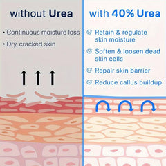 Urea Cream 40 Plus Salicylic Acid 2 Foot Cream