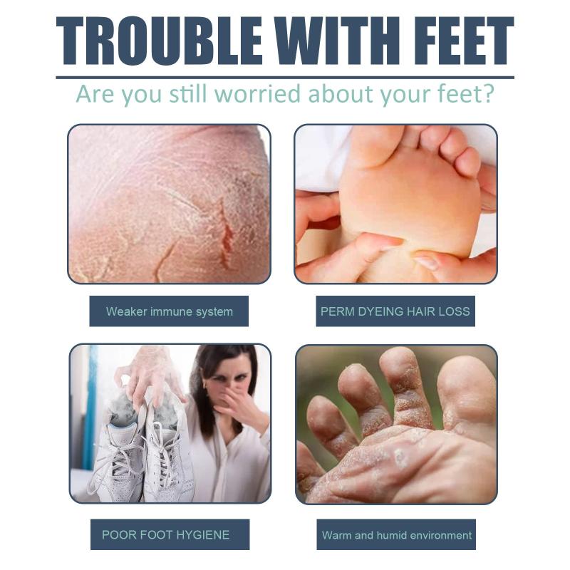 Foot Care Effervescent Tablets for Moisturizing and Cleaning Dead Skin on Feet