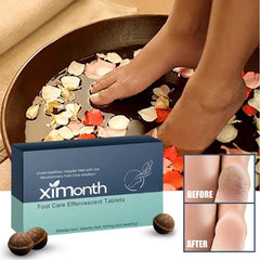 Foot Care Effervescent Tablets for Moisturizing and Cleaning Dead Skin on Feet