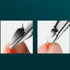 Professional Toenail Clippers for Thick & Ingrown Toenails