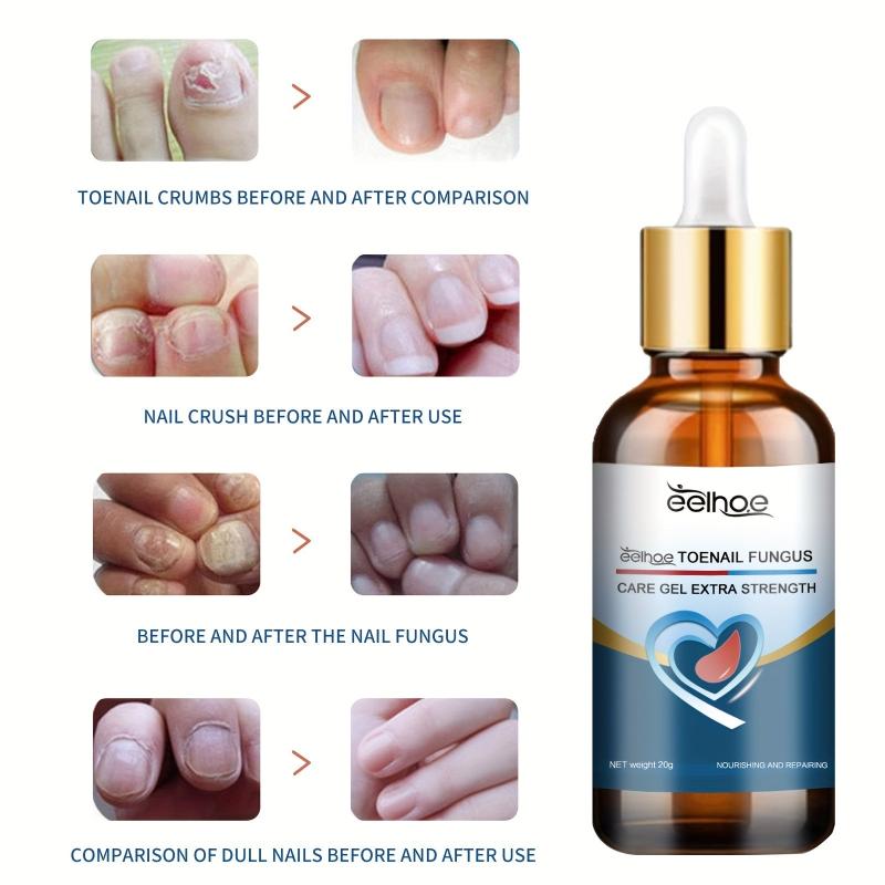 Nail Care Gel for Stronger Nails