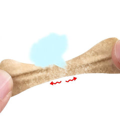 Professional Ingrown Toenail Correction Patch Set