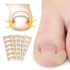 Professional Ingrown Toenail Correction Patch Set