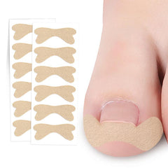 Professional Ingrown Toenail Correction Patch Set