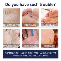 30g Hand and Foot Cream for Dry Cracked Heel Moisturizing Exfoliating Callus
