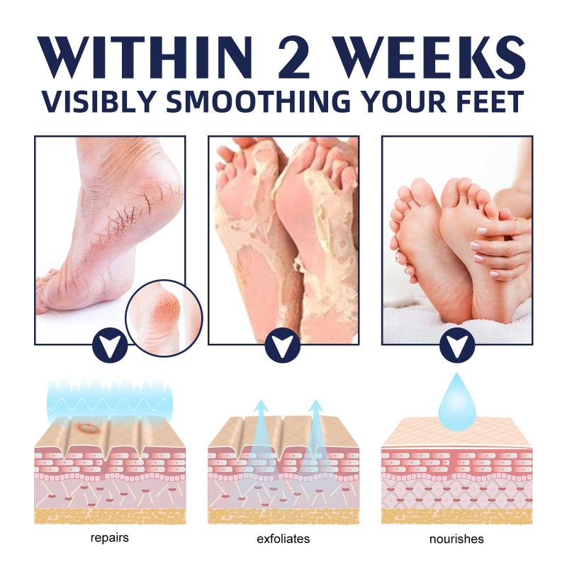 30g Hand and Foot Cream for Dry Cracked Heel Moisturizing Exfoliating Callus