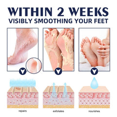 30g Hand and Foot Cream for Dry Cracked Heel Moisturizing Exfoliating Callus