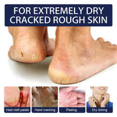 30g Hand and Foot Cream for Dry Cracked Heel Moisturizing Exfoliating Callus