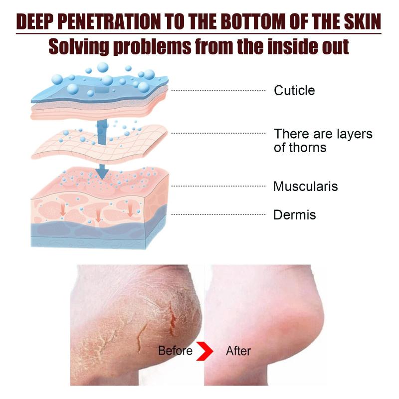 Intensive Foot Repair Balm for Dry, Cracked Feet - Moisturizing Foot Cream