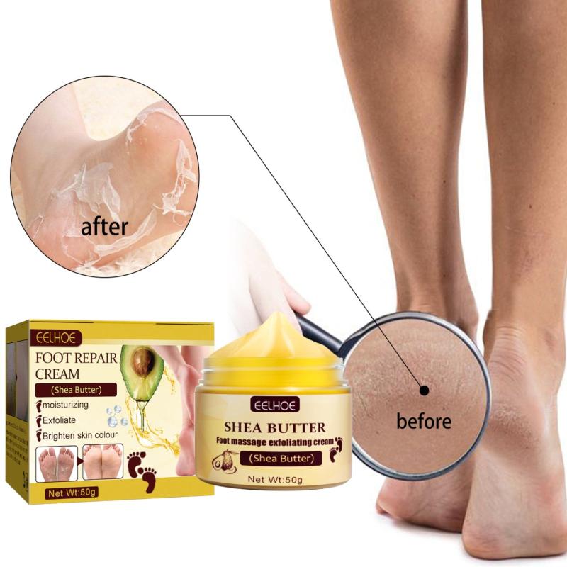 Intensive Foot Repair Balm for Dry, Cracked Feet - Moisturizing Foot Cream