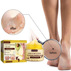 Intensive Foot Repair Balm for Dry, Cracked Feet - Moisturizing Foot Cream